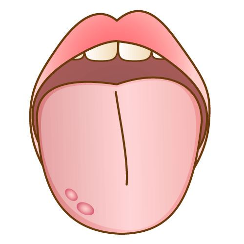口腔粘膜疾患